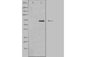Western blot analysis of extracts from RAW264. (SCNN1D Antikörper  (C-Term))