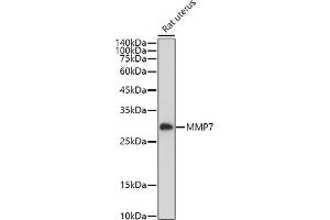 Western Blotting (WB) image for anti-Matrix Metallopeptidase 7 (Matrilysin, Uterine) (MMP7) (AA 18-267) antibody (ABIN3021103)