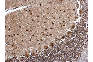 Immunohistochemistry (IHC) image for anti-B-Cell CLL/lymphoma 7A (BCL7A) (C-Term) antibody (ABIN2854648)