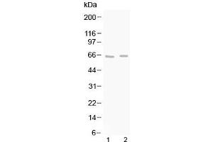 Western blot testing of 1) rat brain and 2) mouse brain lysate with GAD65 antibody at 0.
