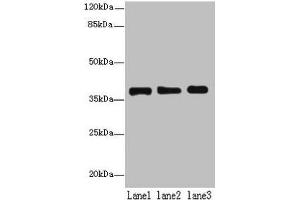Western blot All lanes: MRPL44 antibody at 6 μg/mL Lane 1: Hela whole cell lysate Lane 2: Jurkat whole cell lysate Lane 3: K562 whole cell lysate Secondary Goat polyclonal to rabbit IgG at 1/10000 dilution Predicted band size: 38 kDa Observed band size: 38 kDa (MRPL44 Antikörper  (AA 31-332))