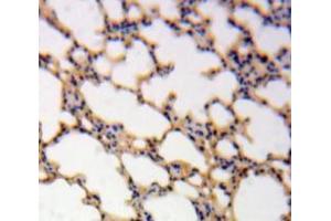Used in DAB staining on fromalin fixed paraffin-embedded Lung tissue (IL-1 beta Antikörper  (AA 117-269))