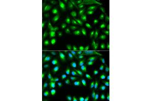 Immunofluorescence analysis of A549 cell using GEMIN2 antibody. (SIP1 Antikörper)