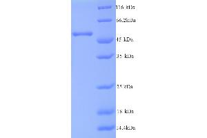 SDS-PAGE (SDS) image for Casein Kinase 1, epsilon (CSNK1E) (AA 1-416), (full length) protein (His tag) (ABIN5713380)