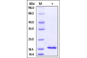 Human IL-10, His Tag on SDS-PAGE under reducing (R) condition. (IL-10 Protein (AA 19-178) (His tag))