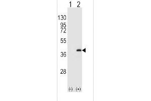 Western blot analysis of P1CB (arrow) using rabbit polyclonal P1CB Antibody  (ABIN392847 and ABIN2842269). (PPP1CB Antikörper  (C-Term))