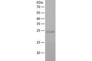Western Blotting (WB) image for Dicarbonyl/L-Xylulose Reductase (DCXR) (AA 1-244) protein (His tag) (ABIN7122656) (DCXR Protein (AA 1-244) (His tag))