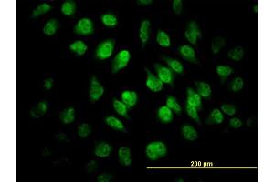 Immunofluorescence of monoclonal antibody to SAFB on HeLa cell. (SAFB Antikörper  (AA 111-200))