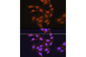 Immunofluorescence analysis of U-2 OS cells using 67 kDa Laminin Receptor Rabbit pAb (ABIN6128199, ABIN6147247, ABIN6147248 and ABIN6224857) at dilution of 1:100 (40x lens). (RPSA/Laminin Receptor Antikörper  (AA 1-295))