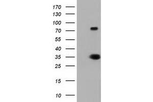 HEK293T cells were transfected with the pCMV6-ENTRY control (Left lane) or pCMV6-ENTRY ERCC1 (Right lane) cDNA for 48 hrs and lysed. (ERCC1 Antikörper)