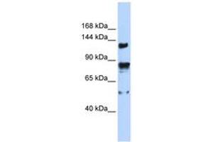 Image no. 1 for anti-Transient Receptor Potential Cation Channel, Subfamily M, Member 4 (TRPM4) (AA 359-408) antibody (ABIN6742557) (TRPM4 Antikörper  (AA 359-408))