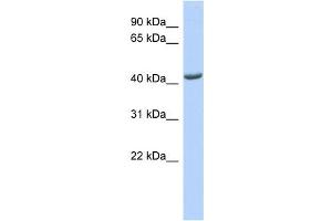 WB Suggested Anti-ST3GAL4 Antibody Titration:  0. (ST3GAL4 Antikörper  (Middle Region))