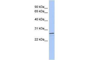 WB Suggested Anti-VSTM2A Antibody Titration: 0. (VSTM2A Antikörper  (Middle Region))