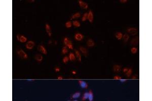 Immunofluorescence analysis of HeLa cells using GPC4 Polyclonal Antibody at dilution of 1:100. (GPC4 Antikörper)
