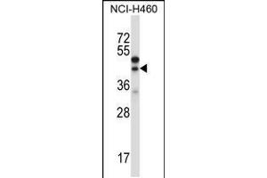 Western blot analysis in NCI-H460 cell line lysates (35ug/lane). (CTGF Antikörper  (AA 166-193))