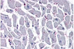 Anti-CYSLTR2 / CYSLT2 antibody  ABIN1048491 IHC staining of human heart. (CasLTR2 Antikörper  (N-Term))