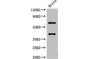 Western Blot Positive WB detected in: Mouse brain tissue All lanes: LRRTM4 antibody at 3 μg/mL Secondary Goat polyclonal to rabbit IgG at 1/50000 dilution Predicted band size: 68, 60 kDa Observed band size: 68, 40 kDa (LRRTM4 Antikörper  (AA 259-419))