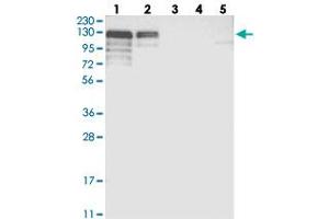 Western blot analysis of Lane 1: RT-4, Lane 2: U-251 MG, Lane 3: Human Plasma, Lane 4: Liver, Lane 5: Tonsil with NHSL1 polyclonal antibody  at 1:250-1:500 dilution. (NHSL1 Antikörper)