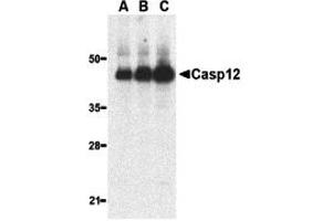 Western Blotting (WB) image for anti-Caspase 12 (Gene/pseudogene) (CASP12) (Large Isoform) antibody (ABIN1031699) (Caspase 12 Antikörper  (Large Isoform))