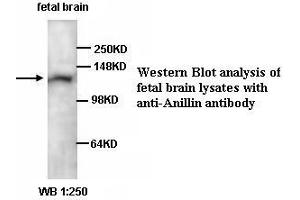 Image no. 1 for anti-Anillin, Actin Binding Protein (ANLN) antibody (ABIN1574694) (Anillin Antikörper)