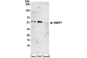 anti-Stromal Membrane Associated Protein 1 (SMAP1) (AA 275-325) antibody