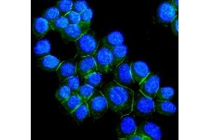 IF analysis of DSG2 using anti-DSG2 antibody (ABIN7600803).