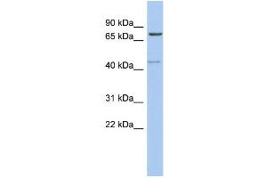 WB Suggested Anti-PEX5 Antibody Titration: 0. (PEX5 Antikörper  (Middle Region))