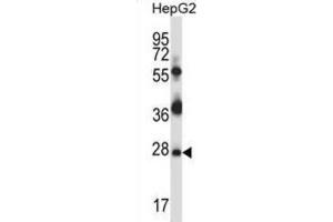 Western Blotting (WB) image for anti-TP53 Regulating Kinase (TP53RK) antibody (ABIN2997879) (TP53RK Antikörper)