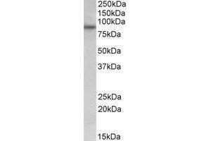 AP23219PU-N FSD1 antibody staining of HeLa lysate at 0. (RUFY1 Antikörper  (Internal Region))