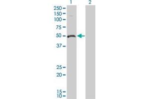 Western Blot analysis of ODC1 expression in transfected 293T cell line by ODC1 monoclonal antibody (M01), clone 2G5.