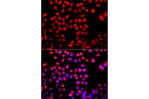 Immunofluorescence analysis of A549 cells using CFL2 antibody (ABIN5974961). (Cofilin 2 Antikörper)