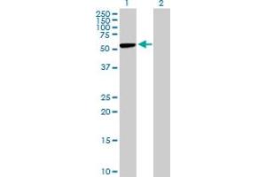 Western Blot analysis of CBS expression in transfected 293T cell line by CBS MaxPab polyclonal antibody. (CBS Antikörper  (AA 1-551))