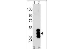 Western blot analysis of PHKG2 (arrow) using PHKG2 Antibody (N-term) (ABIN391341 and ABIN2841365).