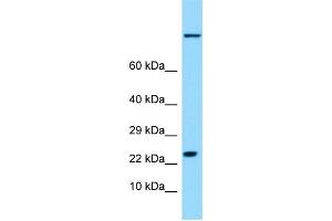WB Suggested Anti-HSPB9 Antibody Titration: 1. (HSPB9 Antikörper  (Middle Region))