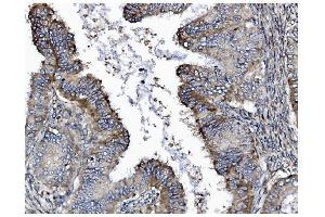 IHC analysis of GSDMD using anti-GSDMD antibody (ABIN7599433). (GSDMD Antikörper  (AA 1-484))