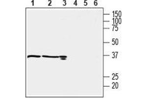 Western blot analysis of mouse kidney (lanes 1 and 4), rat kidney (lanes 2 and 5) (1:600) and rat testis (lanes 3 and 6) (1:200) lysates: - 1-3. (OXGR1 Antikörper  (C-Term, Intracellular))