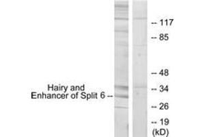 Western blot analysis of extracts from HeLa cells, using HES6 Antibody. (HES6 Antikörper  (AA 1-50))