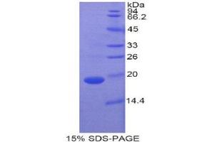SDS-PAGE (SDS) image for Retinol Binding Protein 7, Cellular (RBP7) (AA 1-134) protein (His tag) (ABIN1821784) (RBP7 Protein (AA 1-134) (His tag))