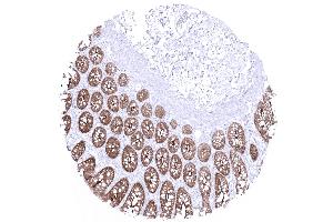 colon descendens mucosa (Rekombinanter Villin 1 Antikörper  (AA 600-700))