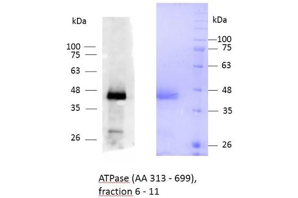 ATP2C1 Protein (AA 313-699) (His tag)