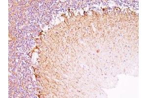 Formalin-fixed, paraffin-embedded human cerebellum stained with Neurofilament antibody (NR-4). (Neurofilament Antikörper)