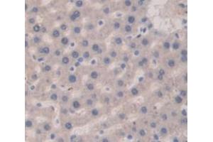 IHC-P analysis of Rat Tissue, with DAB staining. (Vitamin D-Binding Protein Antikörper  (AA 395-475))