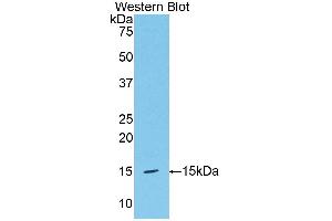 Western blot analysis of the recombinant protein. (HPSE Antikörper  (AA 419-535))