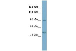 WB Suggested Anti-PKP2 Antibody Titration: 0. (Plakophilin 2 Antikörper  (N-Term))