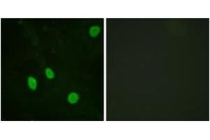 Immunofluorescence analysis of HeLa cells, using Cyclin H (Ab-315) Antibody. (Cyclin H Antikörper  (AA 274-323))