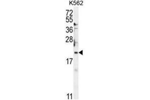 BTG2 Antibody (N-term) western blot analysis in K562 cell line lysates (35µg/lane).