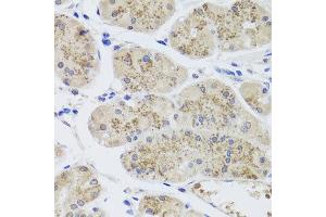 Immunohistochemistry of paraffin-embedded human stomach using MTERFD3 antibody at dilution of 1:100 (x40 lens). (MTERFD3 Antikörper)