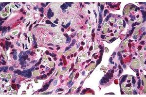 Human Placenta: Formalin-Fixed, Paraffin-Embedded (FFPE) (RBX1 Antikörper  (C-Term))