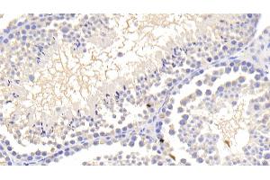 Immunohistochemistry (IHC) image for anti-Leptin (LEP) (AA 22-167) antibody (ABIN7429178)