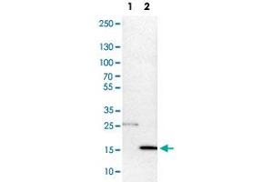 Western Blot analysis of Lane 1: NIH-3T3 cell lysate (mouse embryonic fibroblast cells) and Lane 2: NBT-II cell lysate (Wistar rat bladder tumor cells) with DNAL4 polyclonal antibody . (DNAL4 Antikörper)